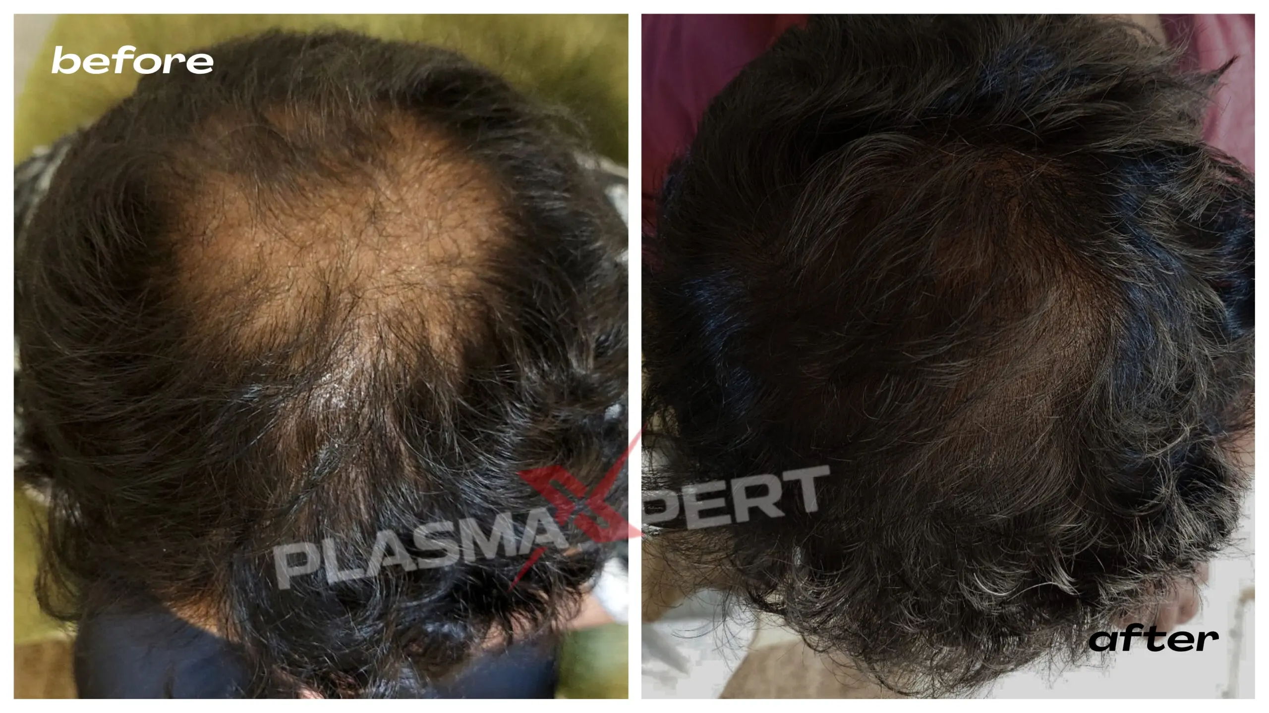 Hair treatment before and after result